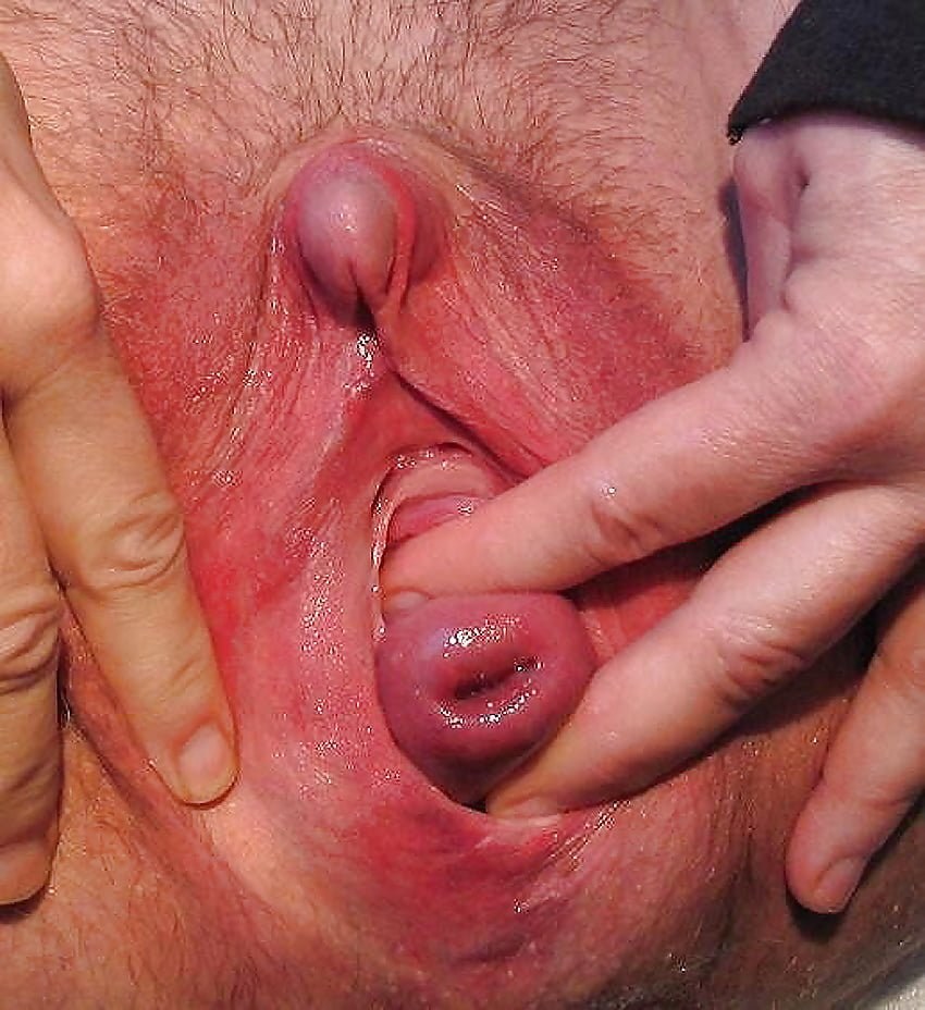 Cervical uterine orgasm