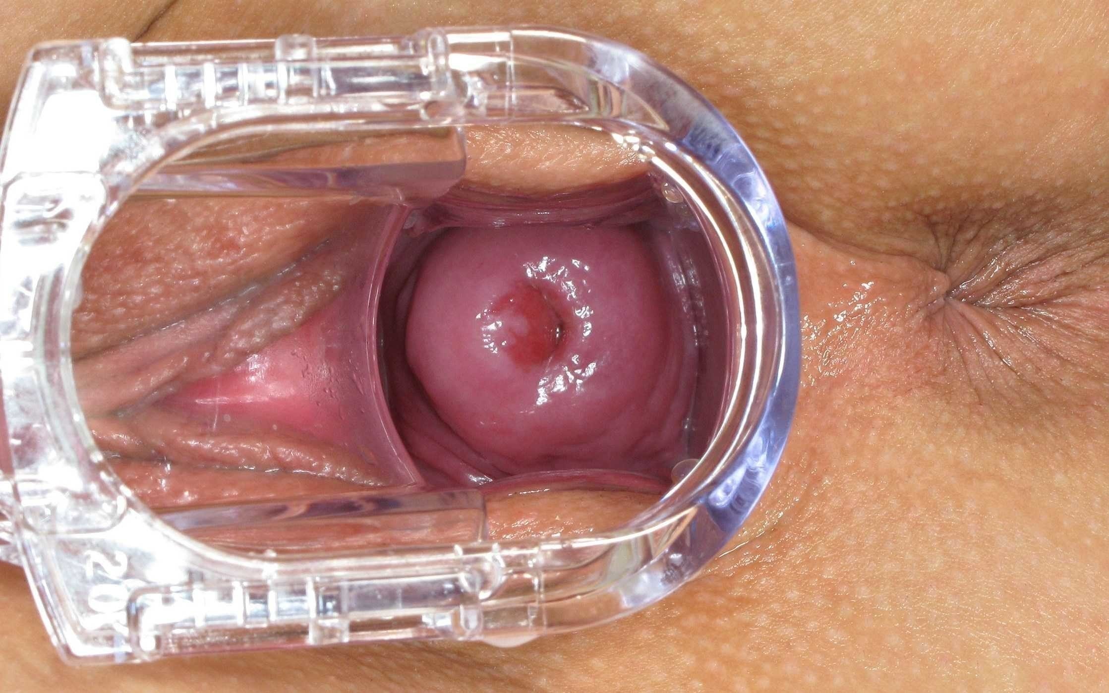 Camera inside vagina teen