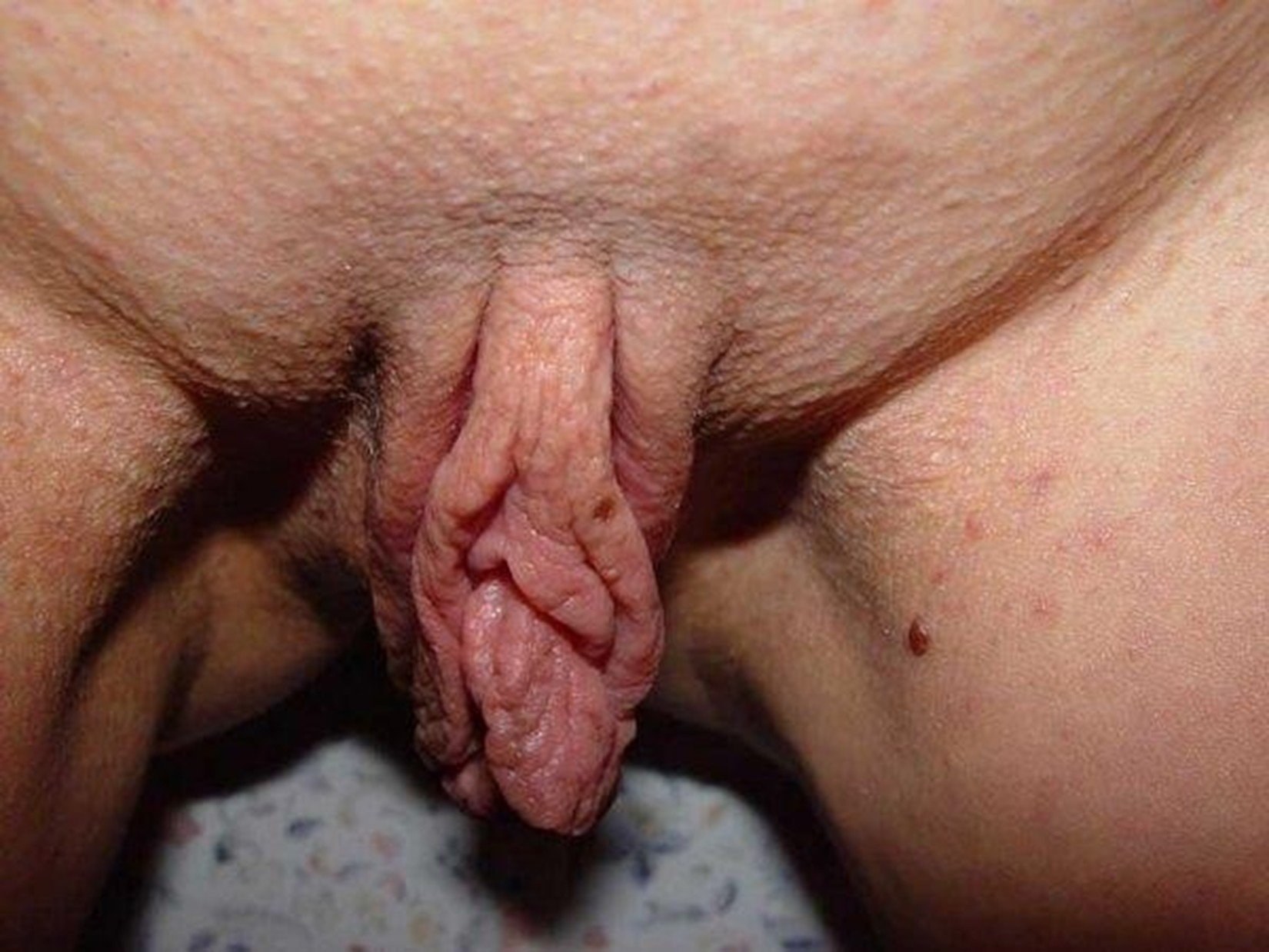 Жирные половые губы фото