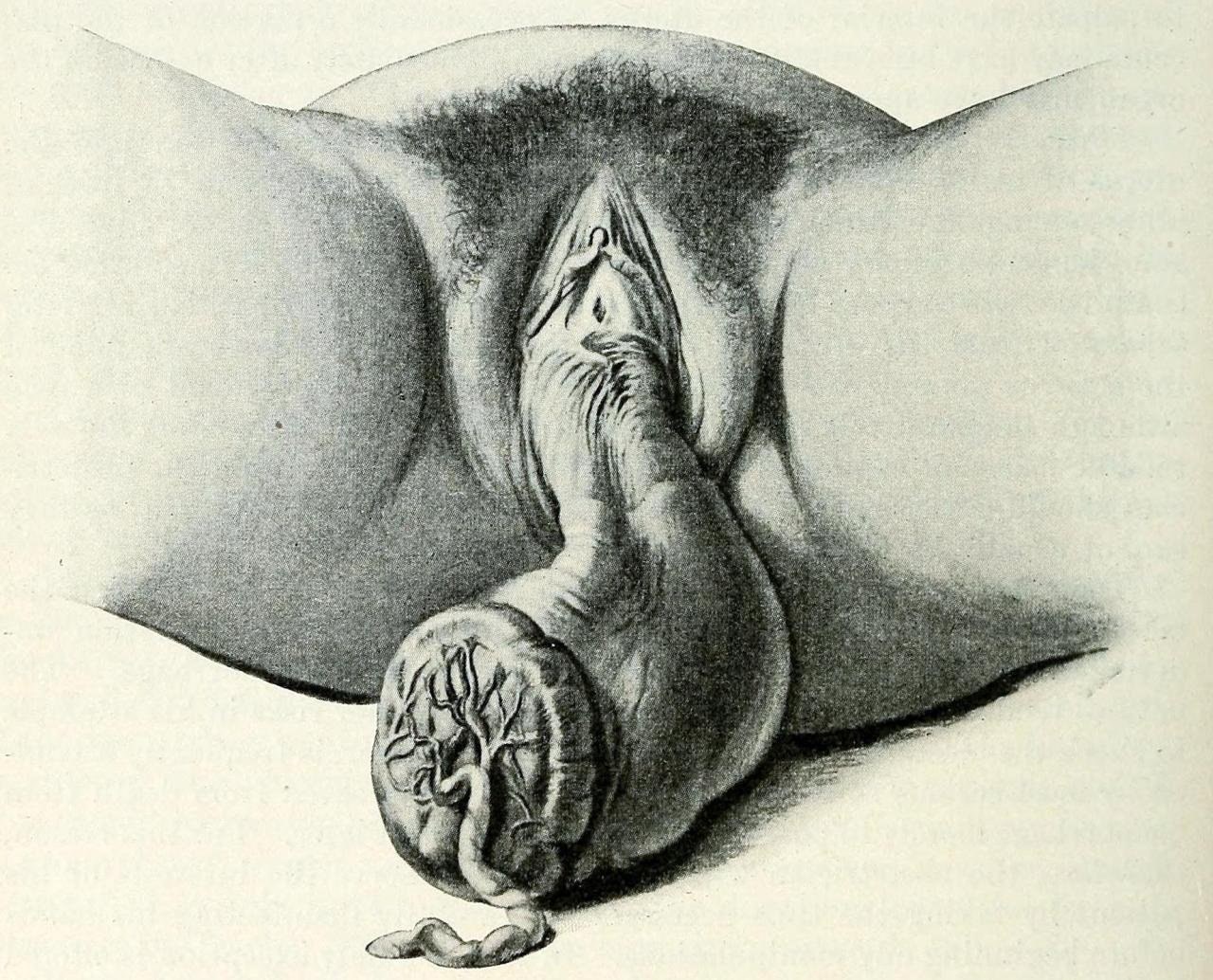 голые женские гениталии фото 64