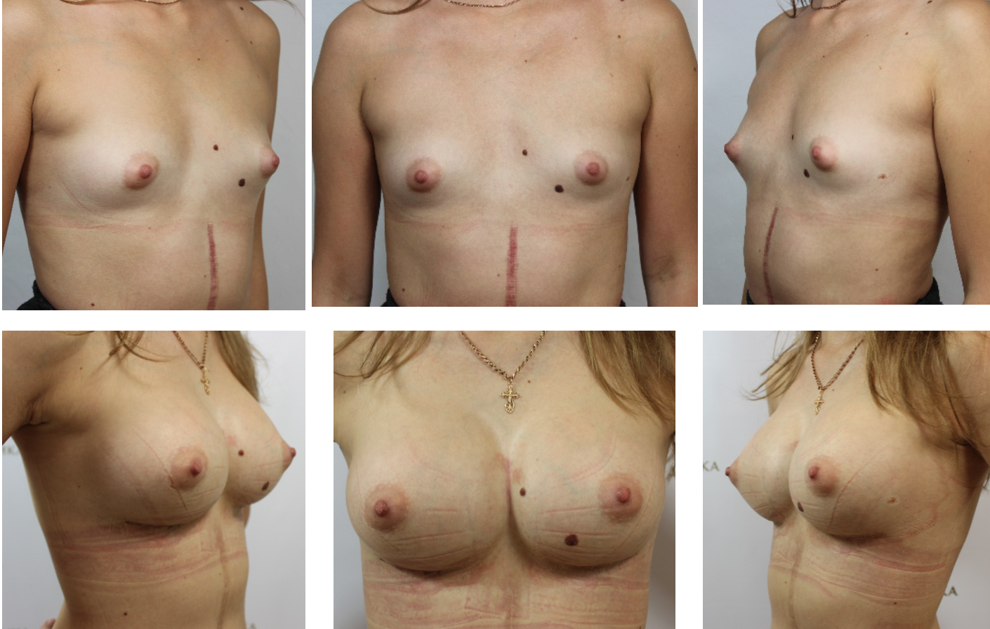 формы женской обнаженной груди фото 11