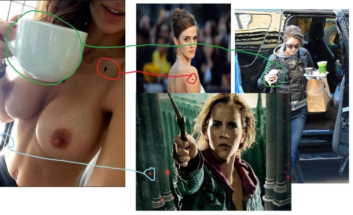 Выпала сиська у подростка