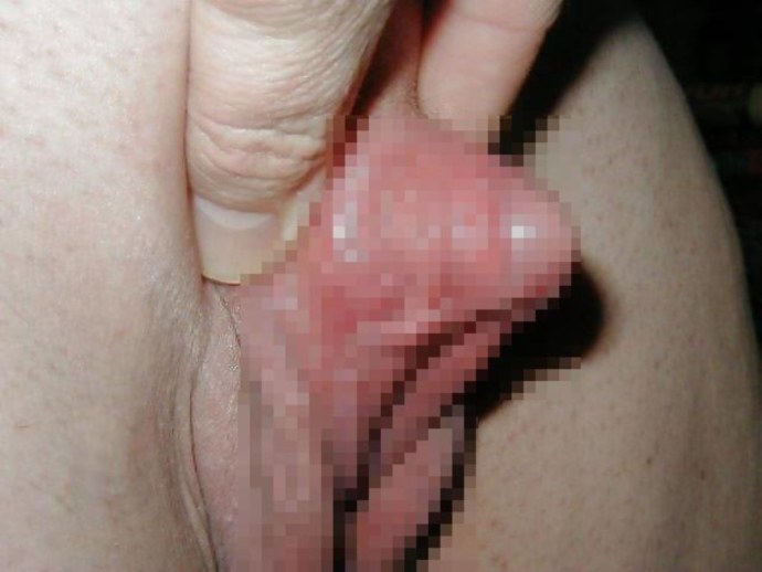 Самый большой клитор крупным планом