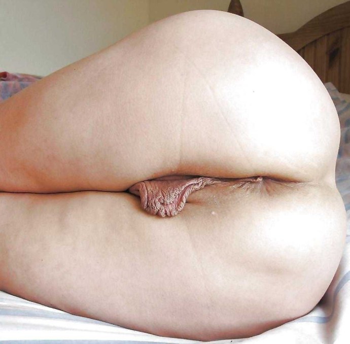 Большие свисающие половые губы