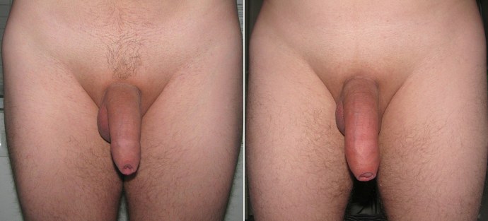 Некрасивый мужской член