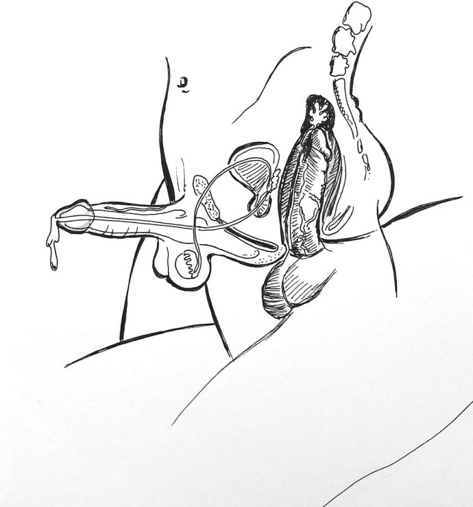 Влагалище изнутри в разрезе