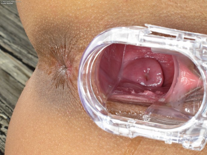 Здоровое влагалище изнутри