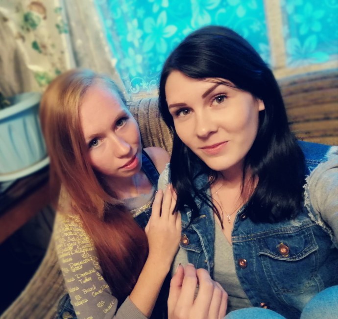 Неудачная верхняя блефаропластика