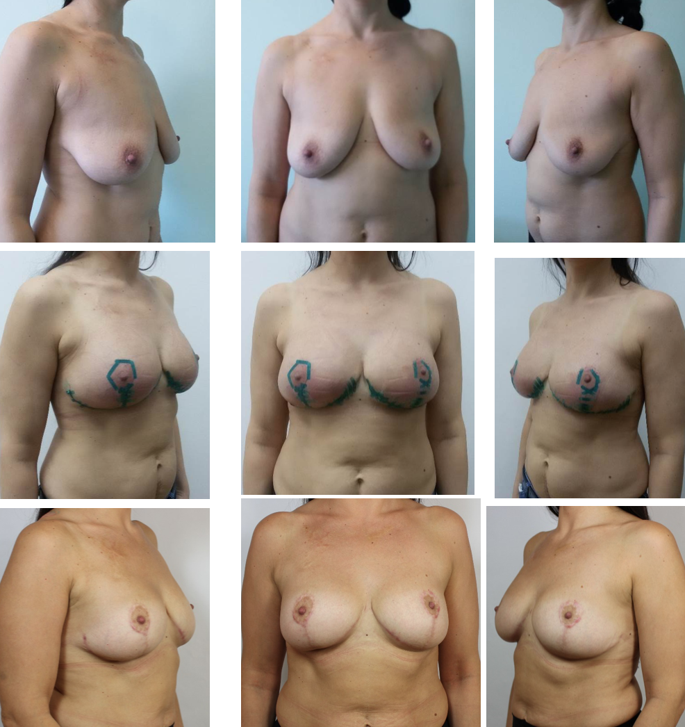 формы женской обнаженной груди фото 12