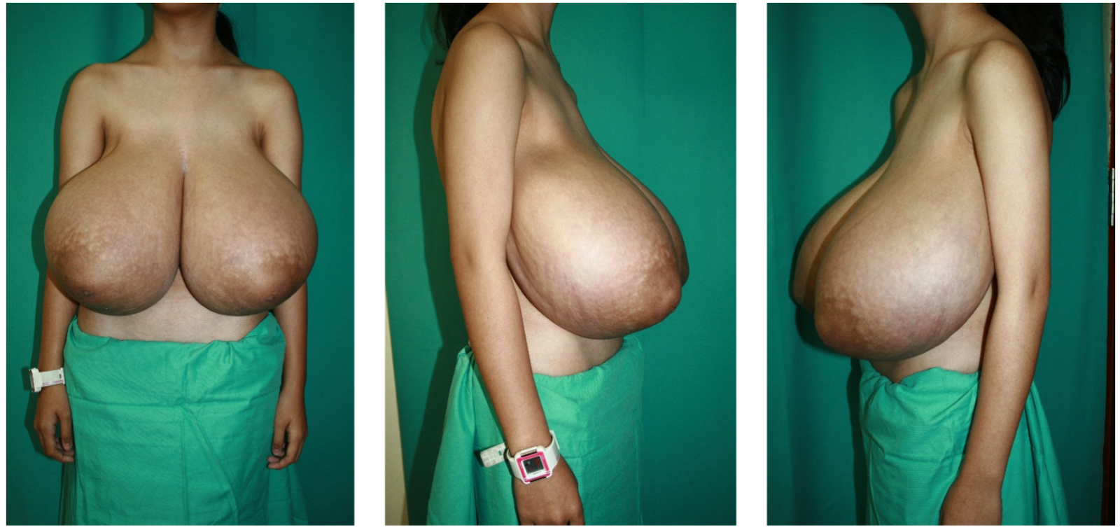 чтобы грудь не обвисла после беременности фото 115