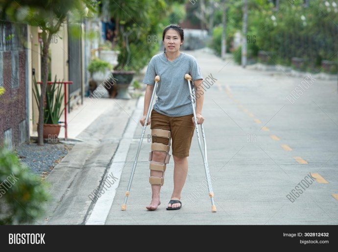 Красивые девушки с инвалидностью