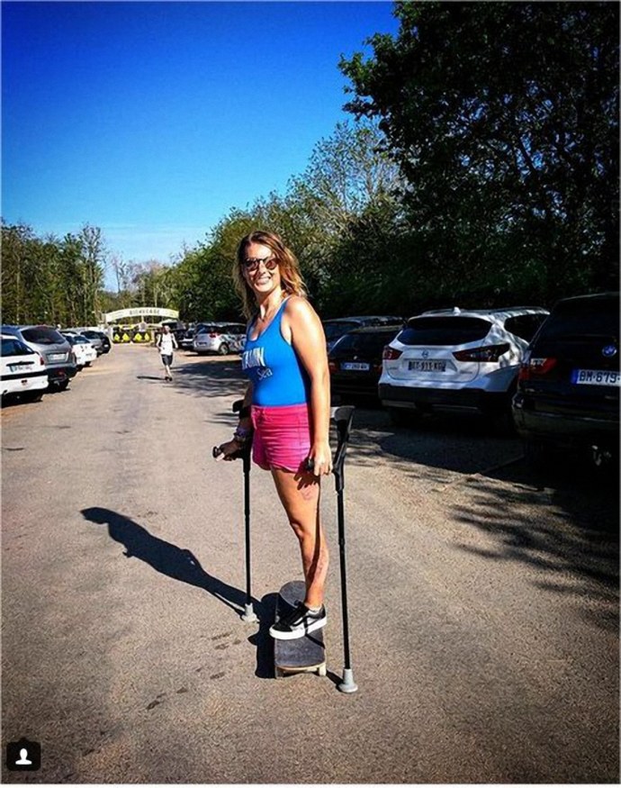 Одноногая ампути Надира Аухадиева