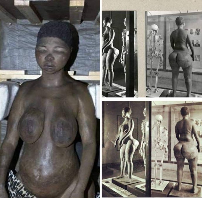 Огромные висячие половые губы