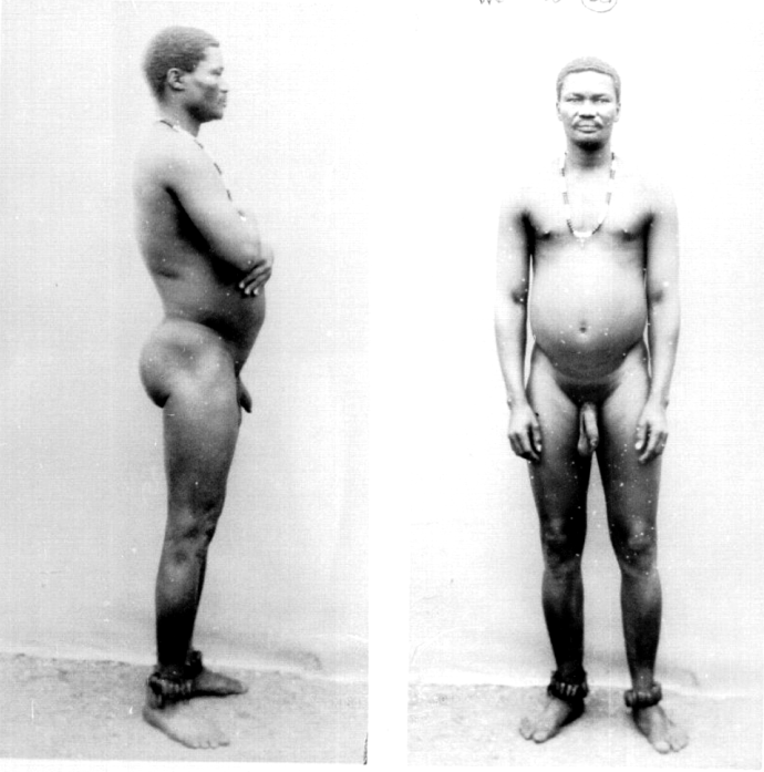 Сара Бартман половые органы