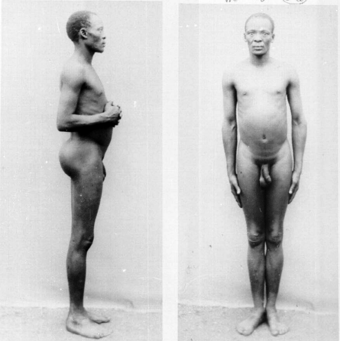 Девушки с большим клитором