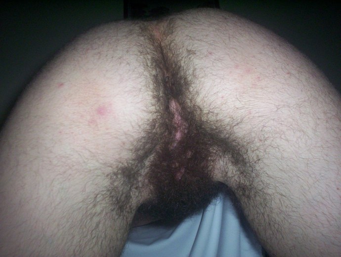 Очень волосатый женский анус