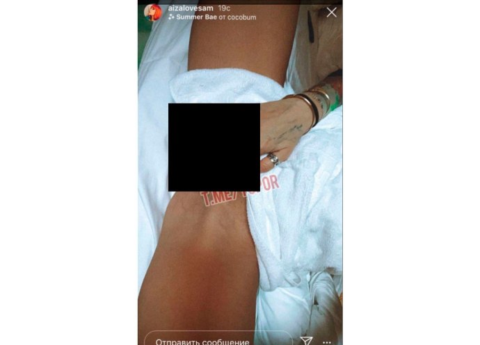 Гениталии Айзы Анохиной порнофото