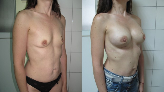 Маленькие сиськи первого размера частное