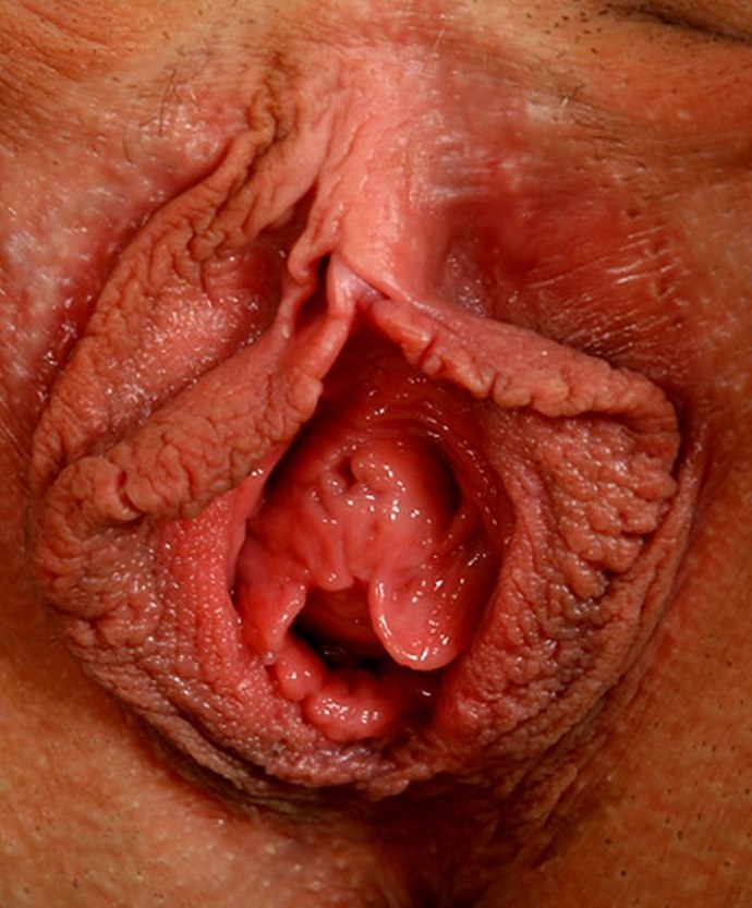 Растянутая вагина крупным планом