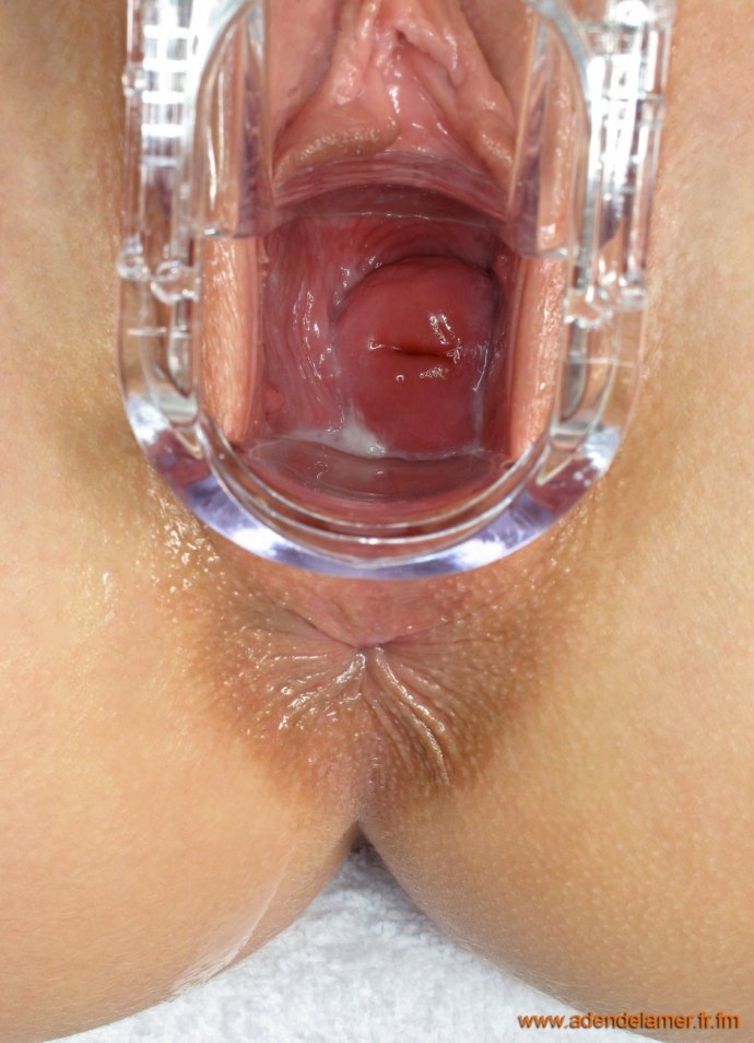 Вагина крупным в разрезе