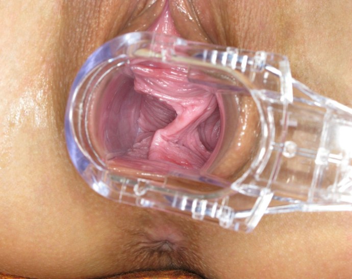 Девушки с расширителем влагалища