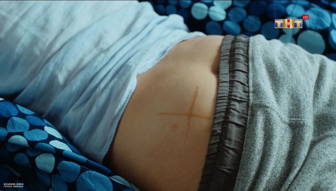 Анекдоты про уколы