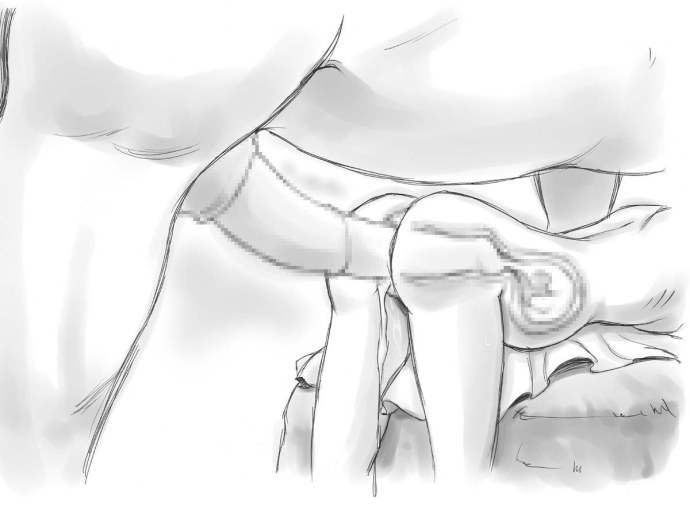 Проникновение члена в матку женщины