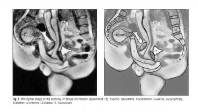 Половой орган во влагалище