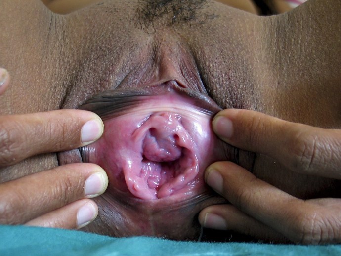 Женская вагина изнутри