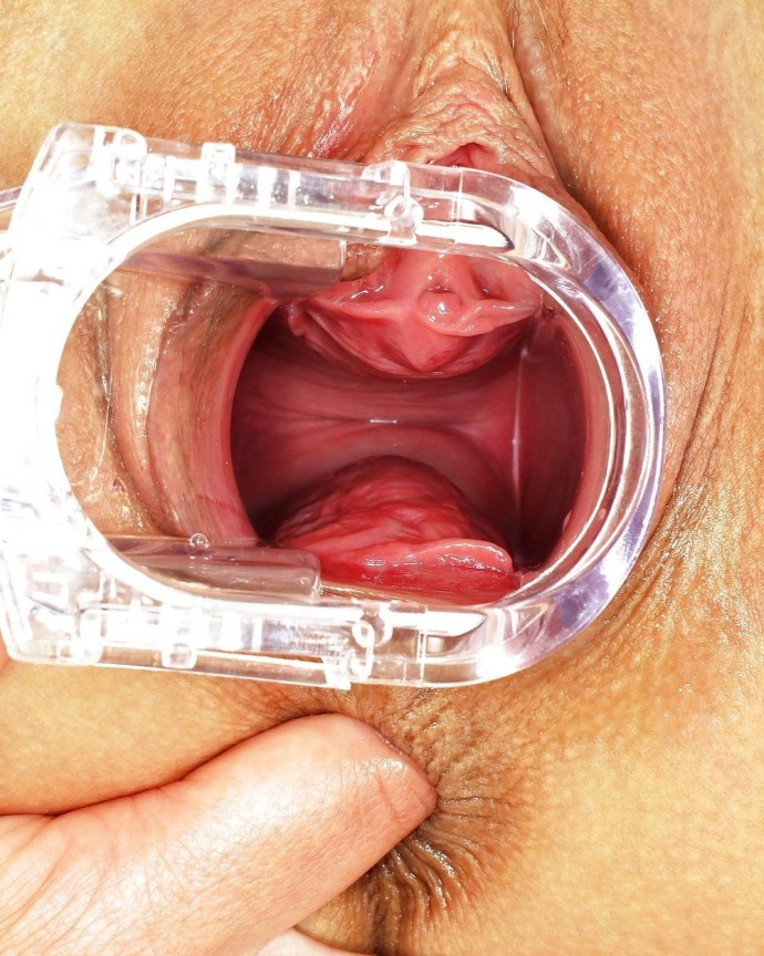 Внутри влагалища крупно