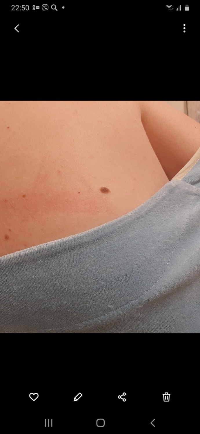 Анальное отверстие домашнее