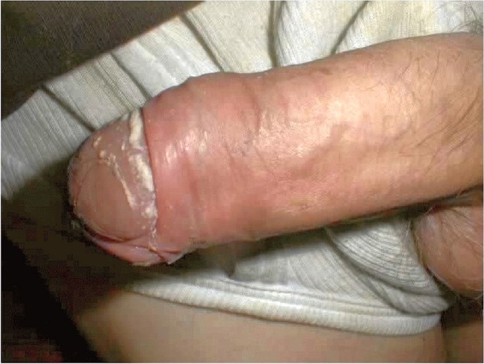 Член в говне после анала