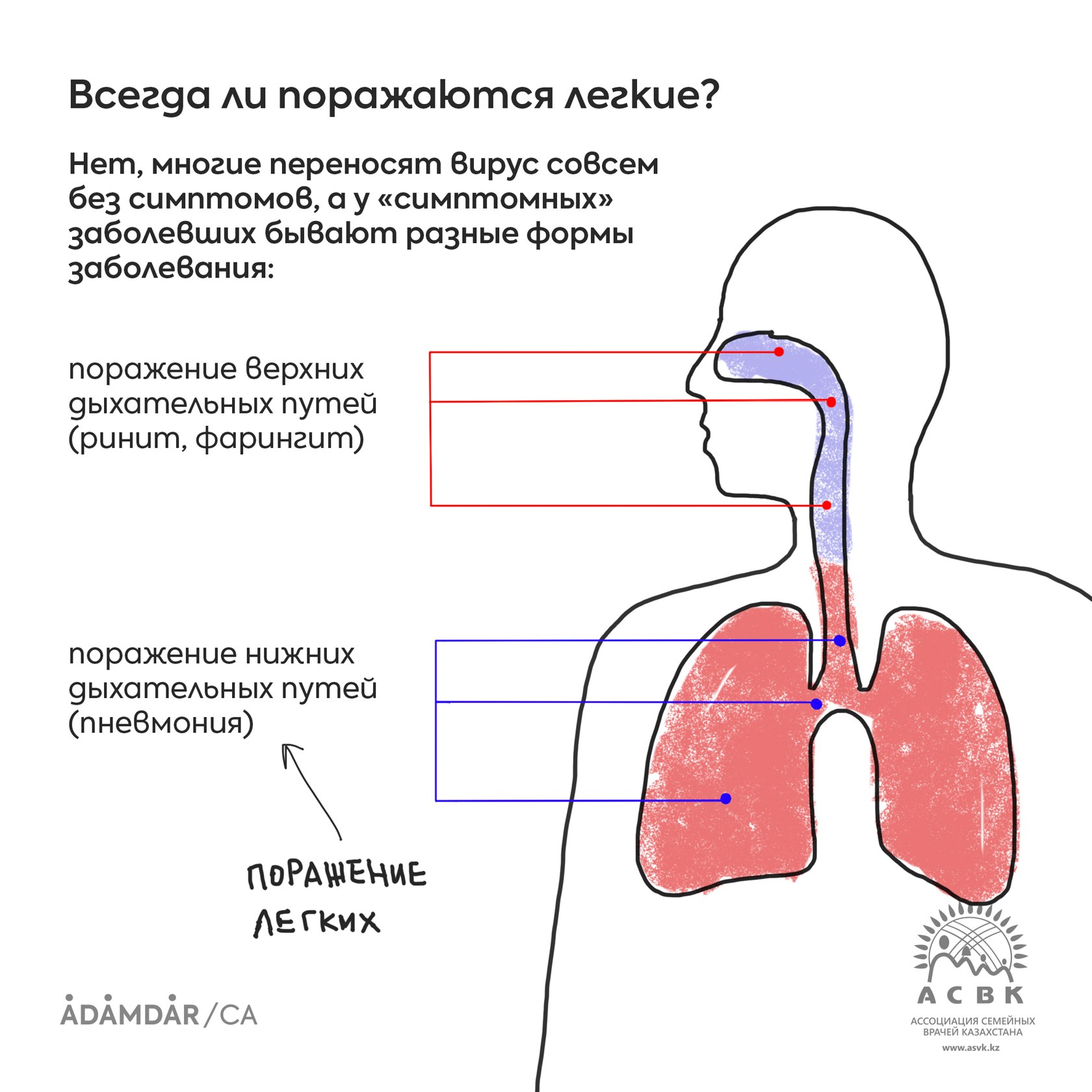 Какие симптомы легких. Легкие при легкие легкие легкие. Поражение лёгких симптомы.