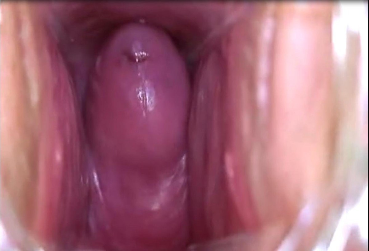вагина из внутри порно фото 50