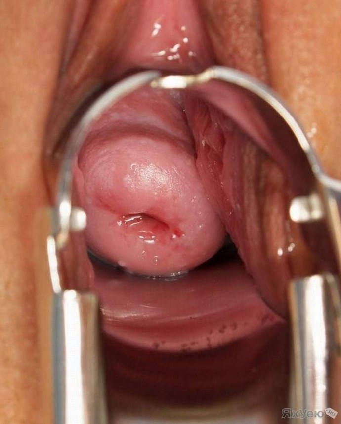 Съемка внутри влагалища