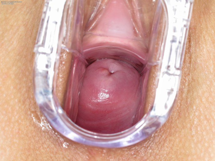 Влагалище и матка изнутри