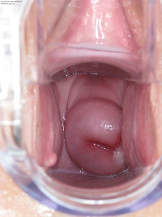 Хентай анальный паразит XRAY