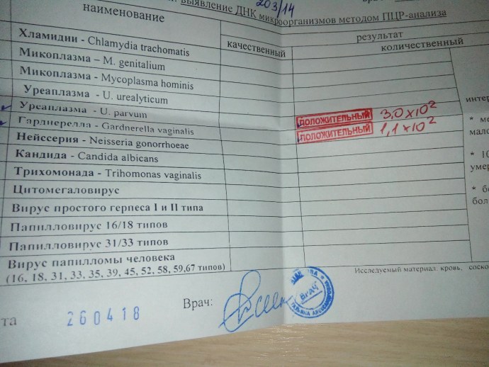 Анализ на хламидиоз