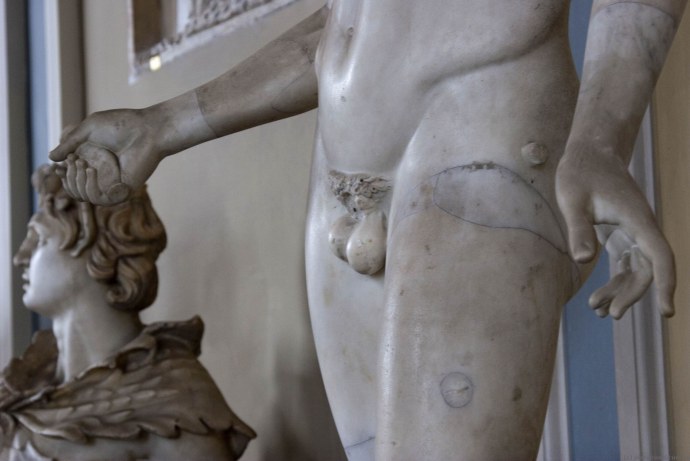 Женщина с мужскими гениталиями