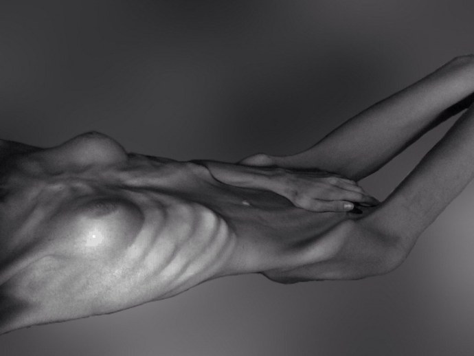 Анорексичные девушки ню