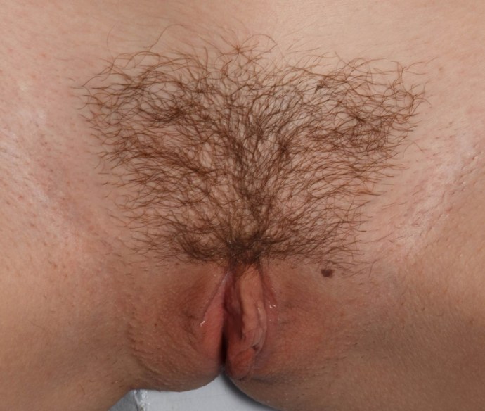 Волосатый треугольник на лобке