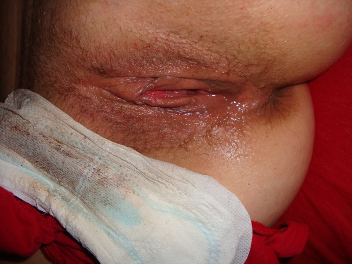 Вагина при менструации