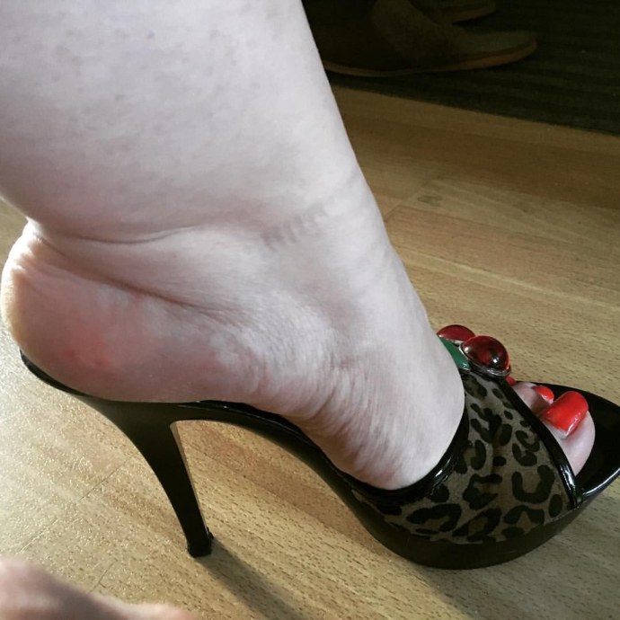 Толстые ноги в т уфляхуфлях