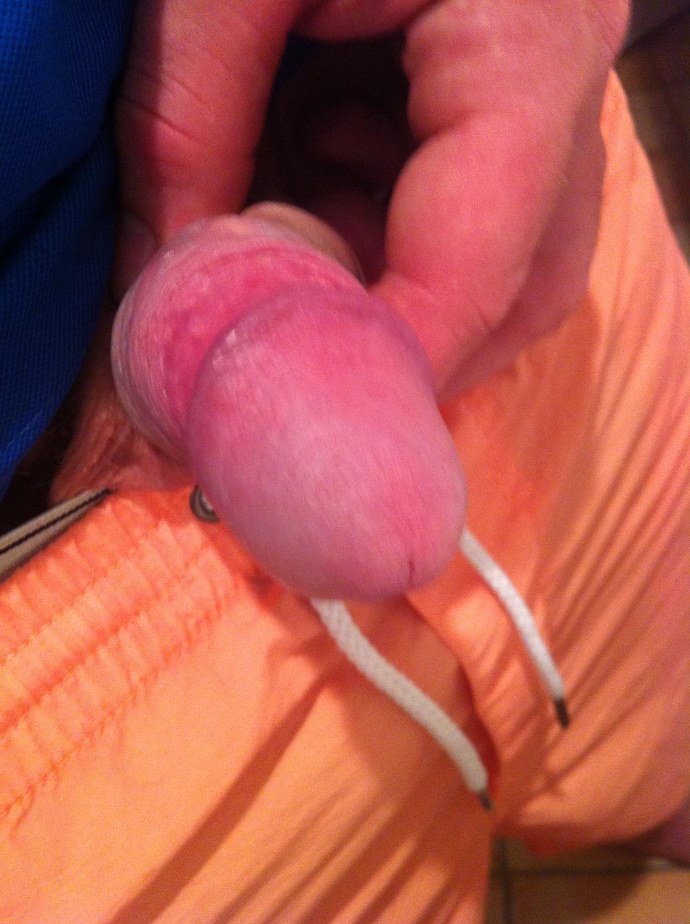 Кольцо на член с анальным шаром