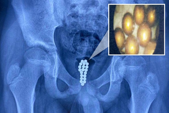 Снимок полового органа