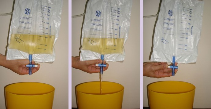 Как слить мочу из мочеприемника