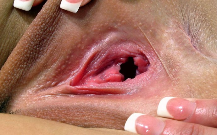 Большая пробка в анусе