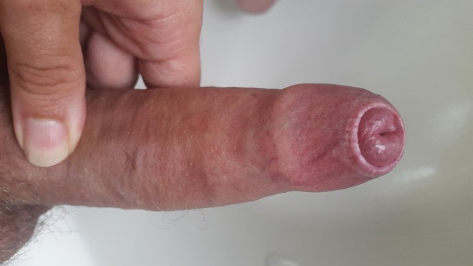 Подростковые пенисы с крайней плотью