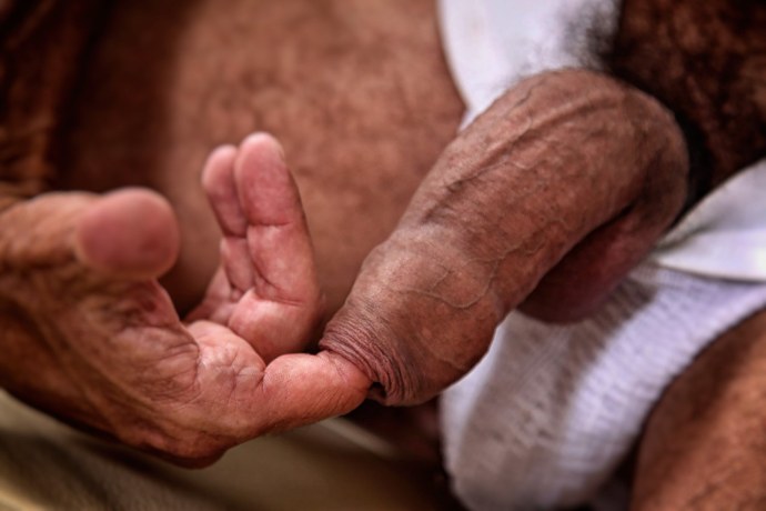 Мужские пенисы с крайней плотью