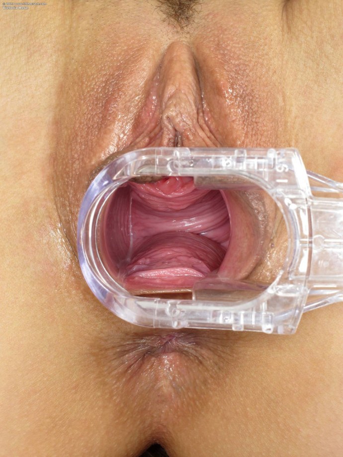 Вагинальный расширитель